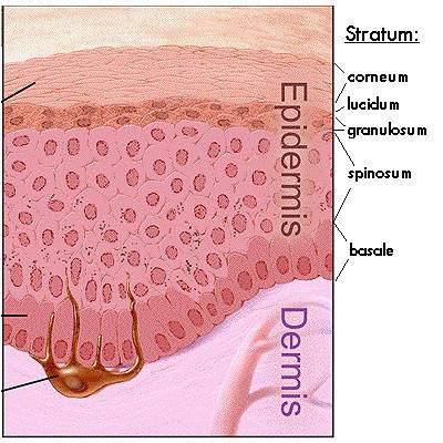 Basal Cell Carcinoma (BCC) - SkinCancer.org