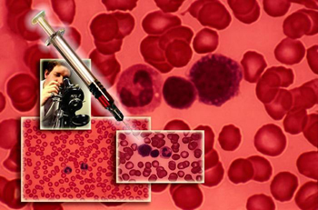 Blood tests: what do they look for?