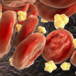 Naturally Manage Cholesterol levels