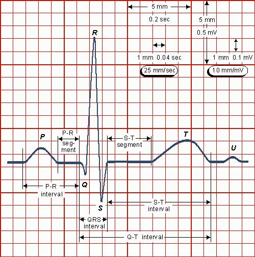 Reading the ECG