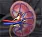 Children Kidney Stones