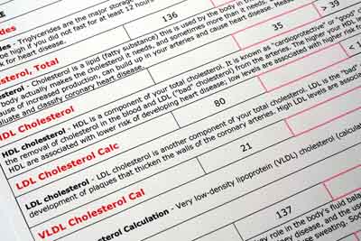 cholesterol chart