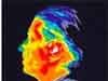 Cell Phone Radiation