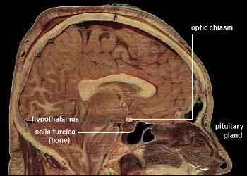 hyothalamus