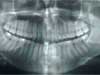 dental-xrays.jpeg