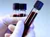 skipping prostate screening test
