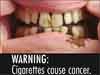 cancer-warning.jpg