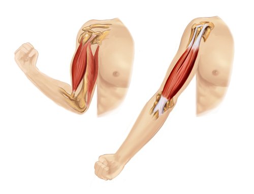 arm muscle illustration