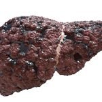Liver Detox