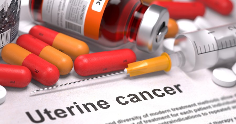 Mediterranean Diet Cuts Uterine Cancer Risk