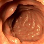 New Fast Food Diet Before Colonoscopy | Health Blog