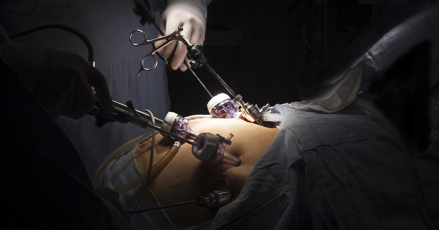 The Top Deadly Emergency Surgeries | Health Blog