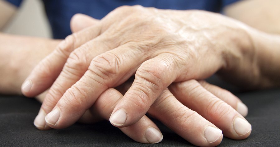 rheumatioid-arthritis.jpg