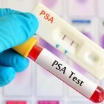 Prostate Cancer Treatment Not Necessary | Cancer Alternatives Blog