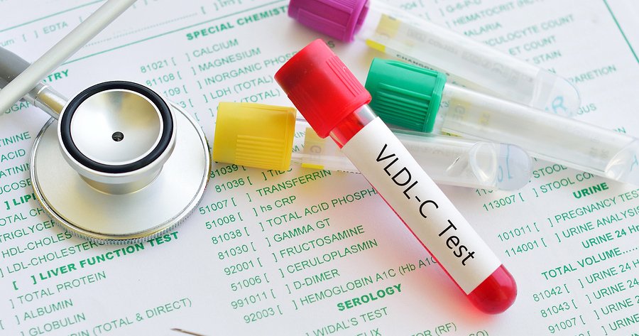 blood tests for cholesterol