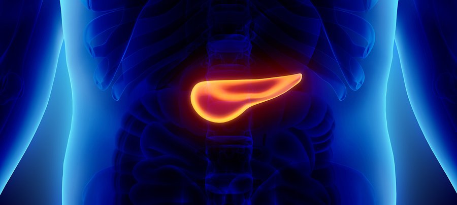 Pancreatic Cancer Due to Obesity