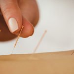 Managing Menopause With Acupuncture