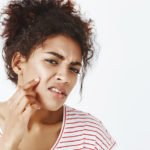 Natural Acne Treatments
