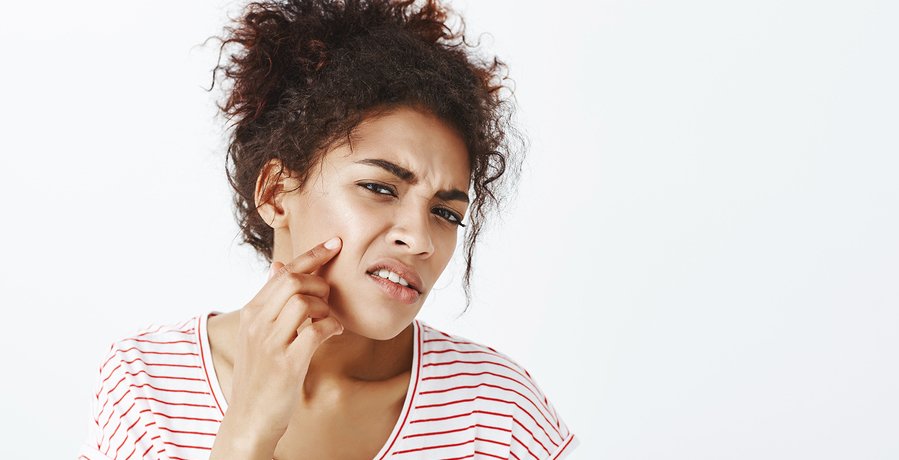 Natural Acne Treatments